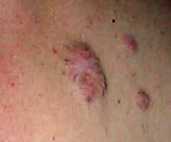 ch�lo�de dos adulte